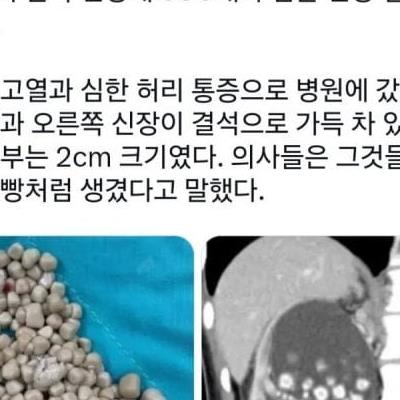 물 안마시고 살면 위험한 이유 ㄷ