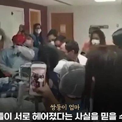 33시간 수술 끝에 서로 얼굴을 보게 된 쌍둥이