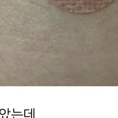 병원에서 주사를 맞았는데.jpg