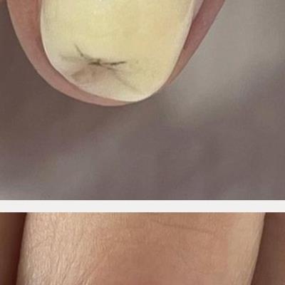 치과의사를 흥분시키는 손톱